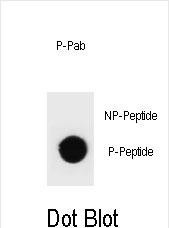 Phospho-TSC1 (Thr417) Antibody in Dot Blot (DB)