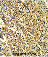 Kir2.1 (KCNJ2) Antibody in Immunohistochemistry (Paraffin) (IHC (P))