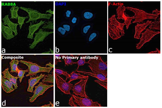 RAB8A Antibody in Immunocytochemistry (ICC/IF)