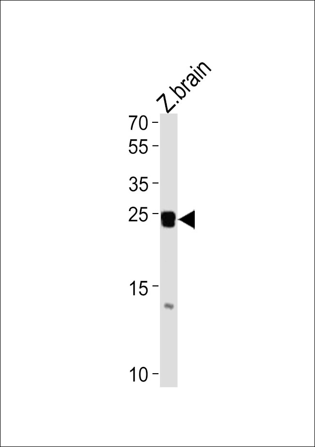 Neurogenin 1 Antibody in Western Blot (WB)