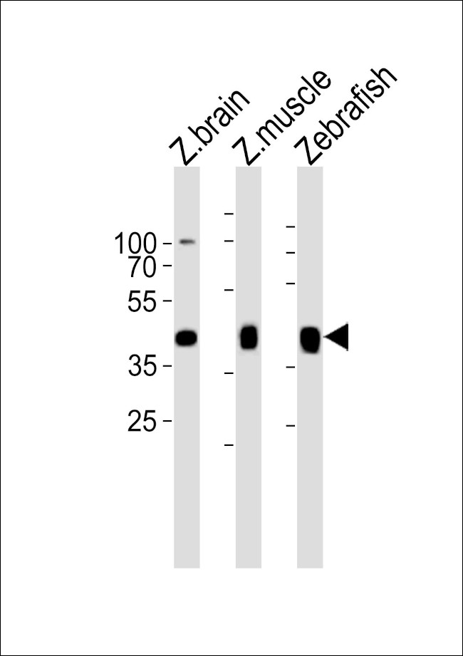 MYLIPB Antibody in Western Blot (WB)