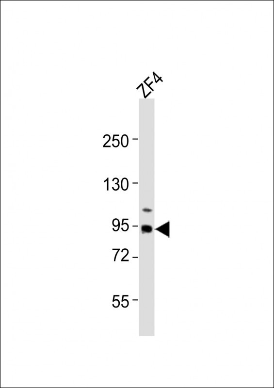 RRM1 Antibody in Western Blot (WB)