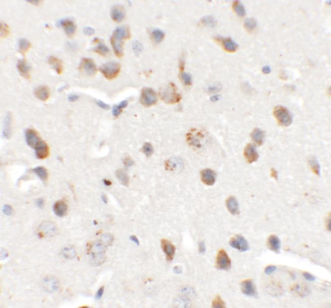 CHD7 Antibody in Immunohistochemistry (Paraffin) (IHC (P))