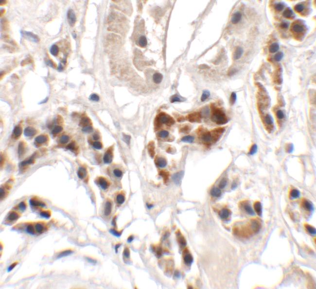 UHRF1BP1 Antibody in Immunohistochemistry (Paraffin) (IHC (P))