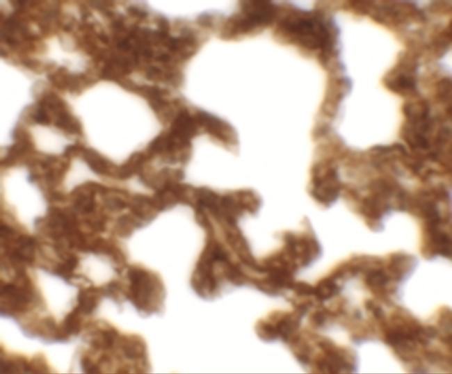 NETO1 Antibody in Immunohistochemistry (Paraffin) (IHC (P))