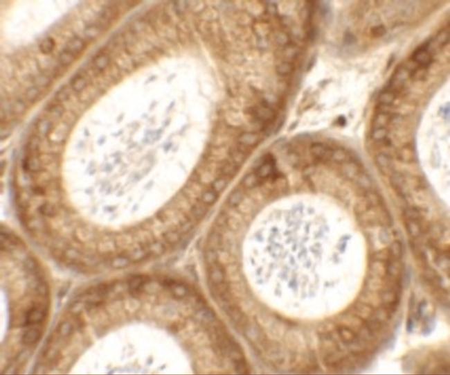 SPATA6 Antibody in Immunohistochemistry (Paraffin) (IHC (P))