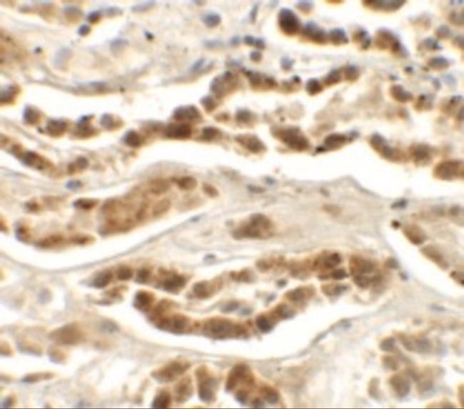 LZTS2 Antibody in Immunohistochemistry (Paraffin) (IHC (P))