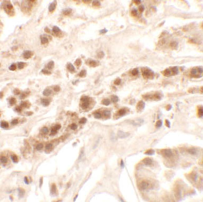 PTCHD2 Antibody in Immunohistochemistry (Paraffin) (IHC (P))