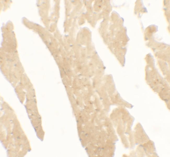 IL1F5 Antibody in Immunohistochemistry (Paraffin) (IHC (P))