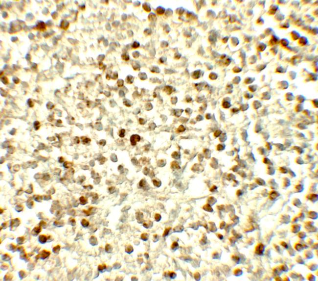 NOX4 Antibody in Immunohistochemistry (Paraffin) (IHC (P))