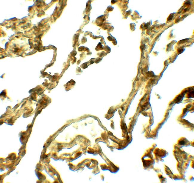 UVRAG Antibody in Immunohistochemistry (Paraffin) (IHC (P))