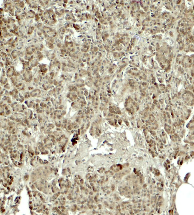 KIRREL2 Antibody in Immunohistochemistry (Paraffin) (IHC (P))