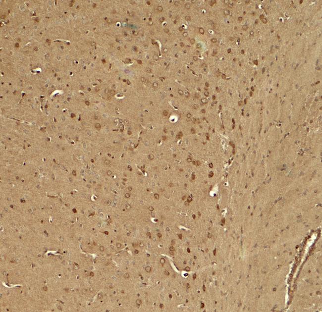 KCNK1 Antibody in Immunohistochemistry (Paraffin) (IHC (P))