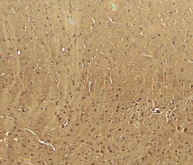 CaV3.2 Antibody in Immunohistochemistry (Paraffin) (IHC (P))