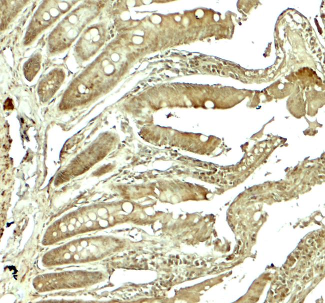 ADORA2B Antibody in Immunohistochemistry (Paraffin) (IHC (P))