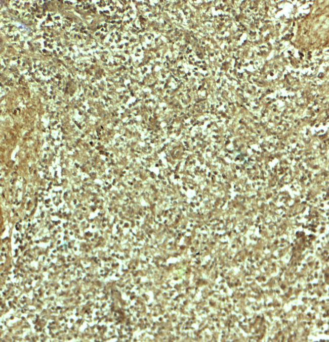 ADRM1 Antibody in Immunohistochemistry (Paraffin) (IHC (P))