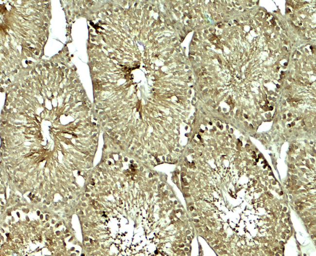 SOX4 Antibody in Immunohistochemistry (Paraffin) (IHC (P))