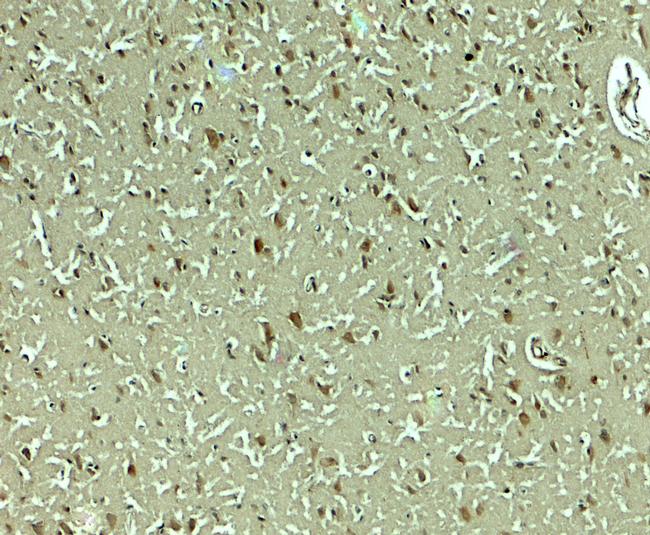 PMAT Antibody in Immunohistochemistry (Paraffin) (IHC (P))