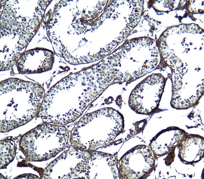 UBD Antibody in Immunohistochemistry (Paraffin) (IHC (P))