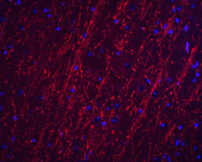 PACS2 Antibody in Immunohistochemistry (Paraffin) (IHC (P))