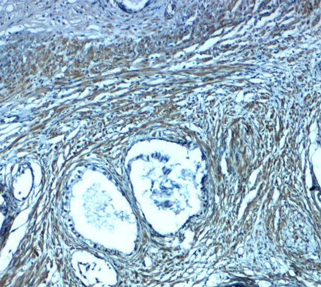 PMEPA1 Antibody in Immunohistochemistry (Paraffin) (IHC (P))