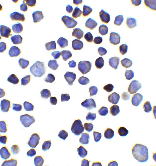 INPP4B Antibody in Immunocytochemistry (ICC/IF)