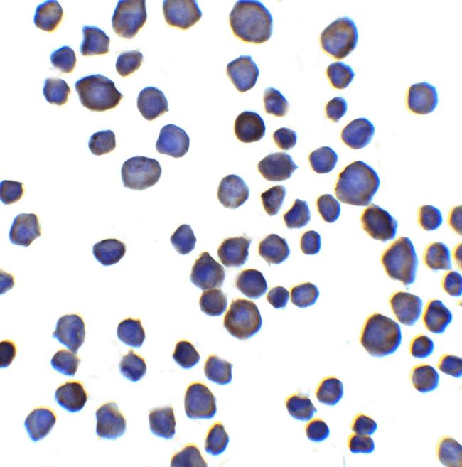 CHAD Antibody in Immunocytochemistry (ICC/IF)