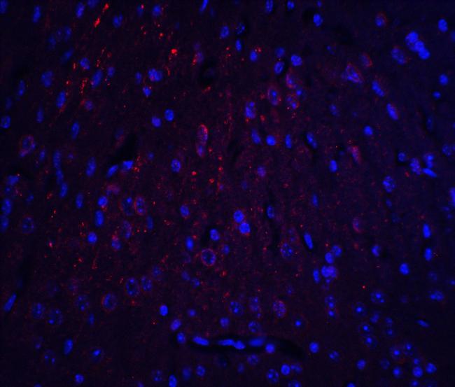 HOOK3 Antibody in Immunohistochemistry (Paraffin) (IHC (P))