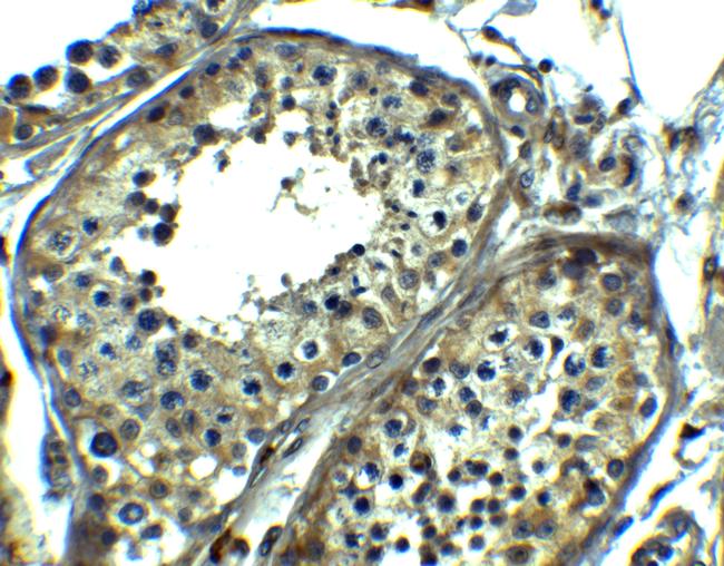 SRPK1 Antibody in Immunohistochemistry (Paraffin) (IHC (P))