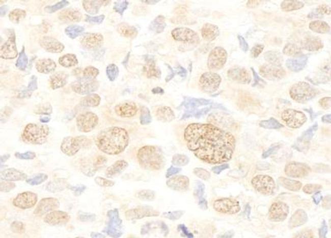 FUSIP1 Antibody in Immunohistochemistry (Paraffin) (IHC (P))