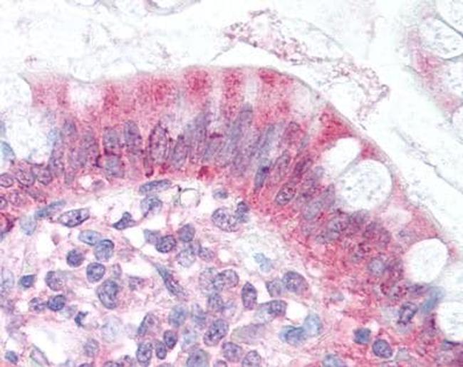 NPC1L1 Antibody in Immunohistochemistry (Paraffin) (IHC (P))