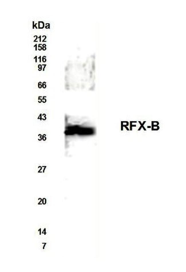 RFXANK Antibody in Western Blot (WB)