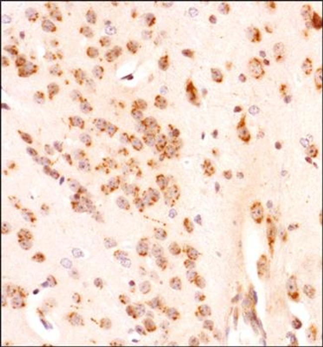 GLI1 Antibody in Immunohistochemistry (Paraffin) (IHC (P))