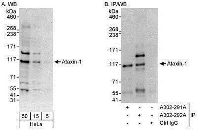 Ataxin 1 Antibody in Western Blot (WB)