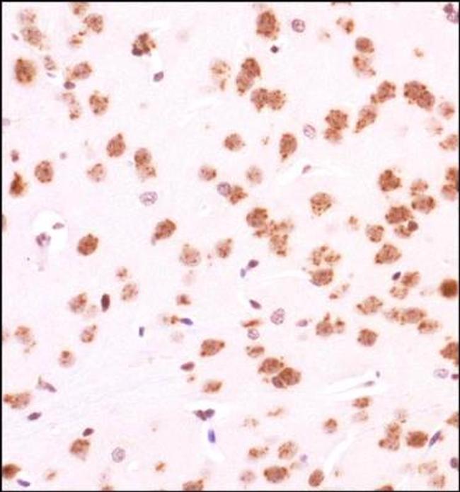 GLI1 Antibody in Immunohistochemistry (Paraffin) (IHC (P))