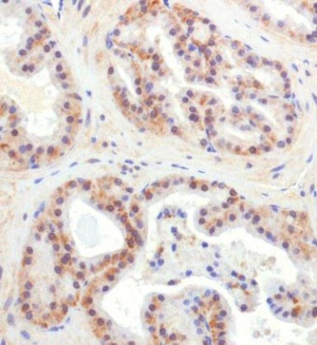 CHORDC1 Antibody in Immunohistochemistry (Paraffin) (IHC (P))