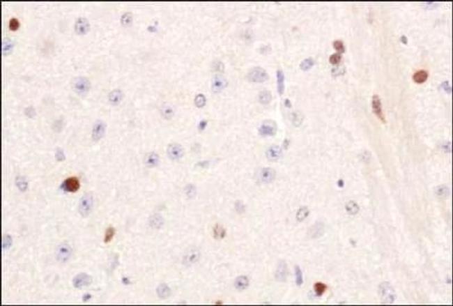 PIF1 Antibody in Immunohistochemistry (Paraffin) (IHC (P))