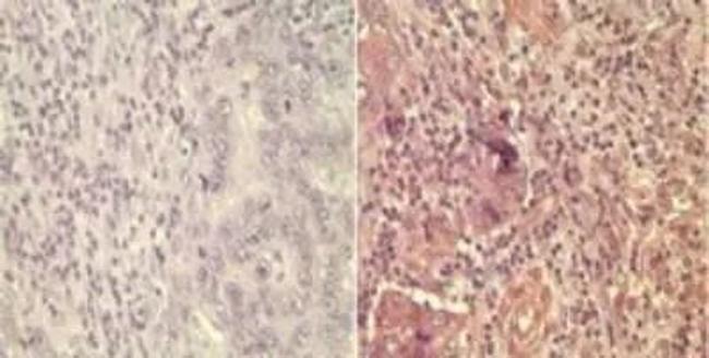 WNT5A Antibody in Immunohistochemistry (Paraffin) (IHC (P))