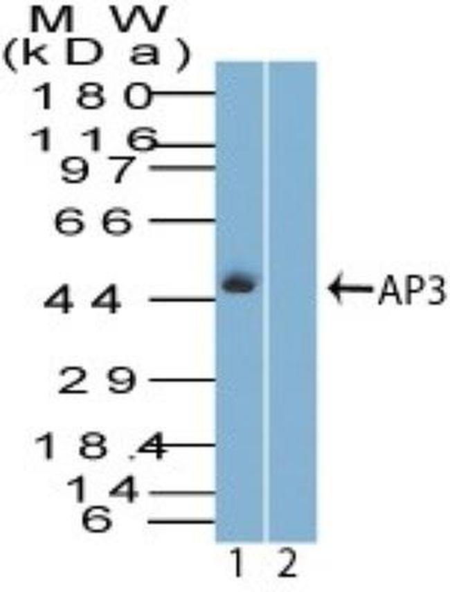 AP3M1 Antibody in Western Blot (WB)