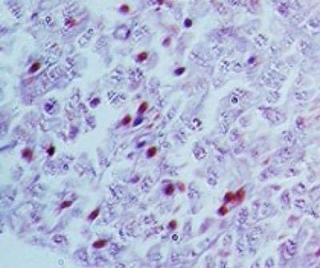 NR5A2 Antibody in Immunohistochemistry (Paraffin) (IHC (P))