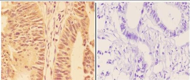 WRAP53 Antibody in Immunohistochemistry (Paraffin) (IHC (P))