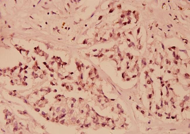 IkB epsilon Antibody in Immunohistochemistry (Paraffin) (IHC (P))