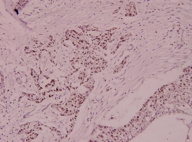 MCM5 Antibody in Immunohistochemistry (Paraffin) (IHC (P))