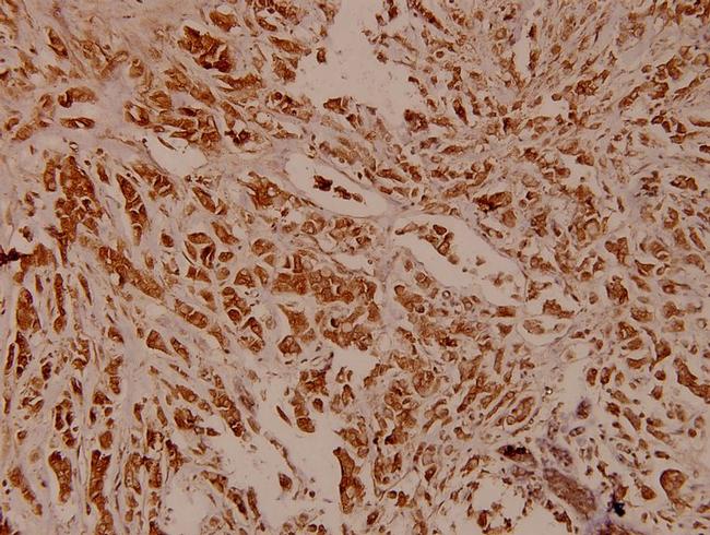 PCAF Antibody in Immunohistochemistry (Paraffin) (IHC (P))