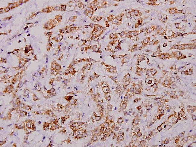 PLA2G4A Antibody in Immunohistochemistry (Paraffin) (IHC (P))