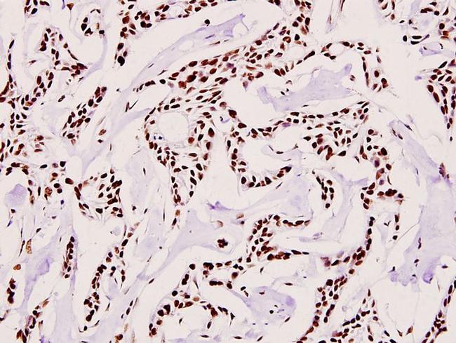 UBA2 Antibody in Immunohistochemistry (Paraffin) (IHC (P))