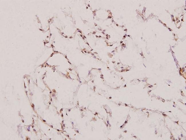 UBE1L Antibody in Immunohistochemistry (Paraffin) (IHC (P))