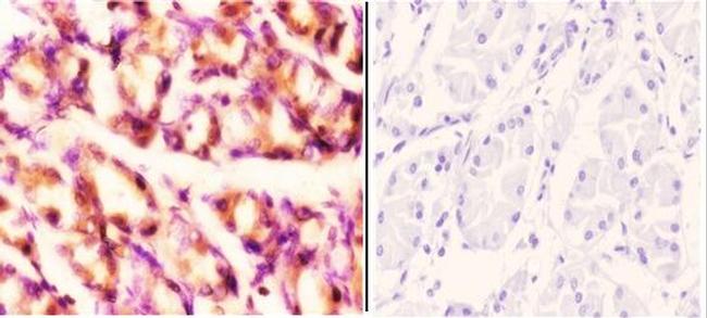 RAD52 Antibody in Immunohistochemistry (Paraffin) (IHC (P))