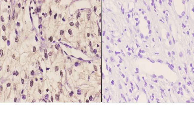 TBX1 Antibody in Immunohistochemistry (Paraffin) (IHC (P))