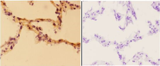 Aldolase A Antibody in Immunohistochemistry (Paraffin) (IHC (P))